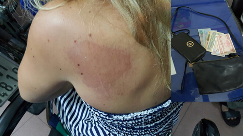 Nữ du khách bị hai người đàn bà kéo lê, cướp túi xách