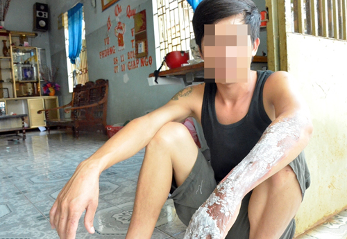 Tạt xăng đốt người vì không được hát đám cưới.