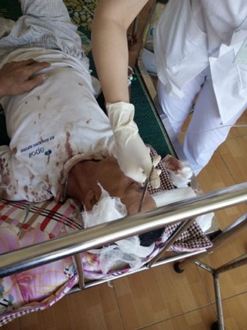 Con dâu thuê 3 băng giang hồ vây đánh bố chồng 65 tuổi