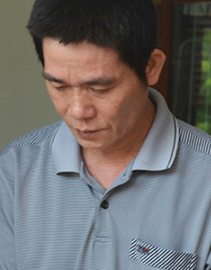 Tên cướp mang chân giả