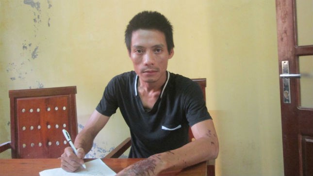 Bị 'mọc sừng', ca sỹ phòng trà 'dạy vợ' bằng axit