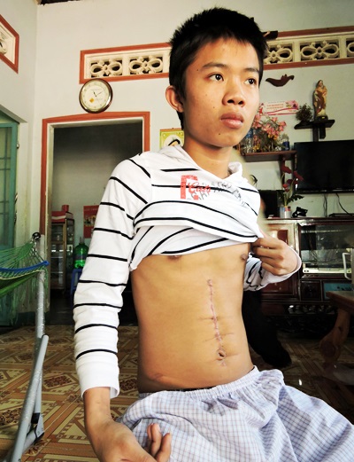 Đánh người dập lá lách, công an và dân quân xã bị khởi tố